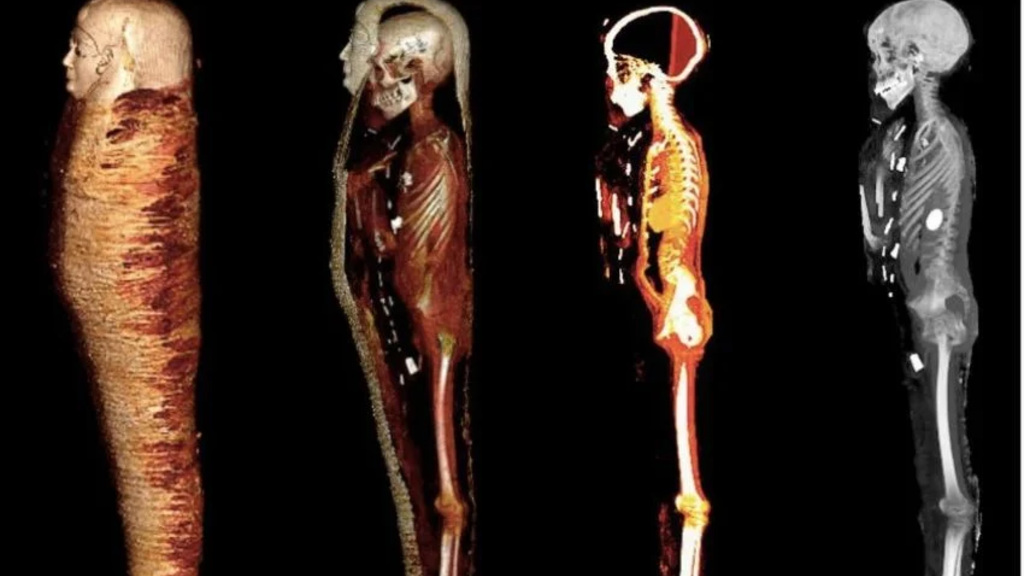 Golden Boy Mummy CT Scan