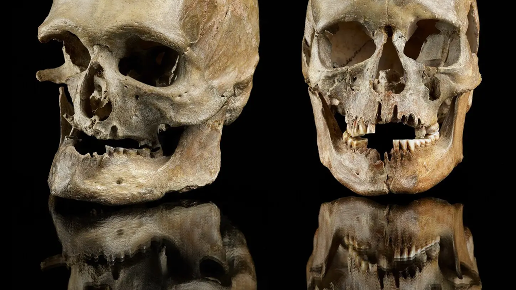 Ancient DNA Skulls