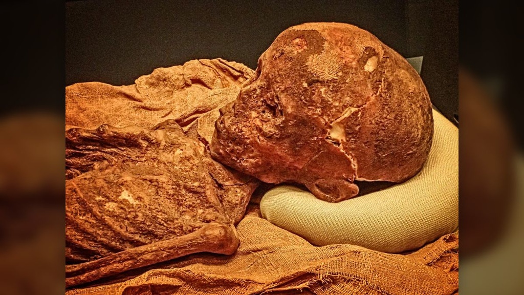 Anemic Mummies
