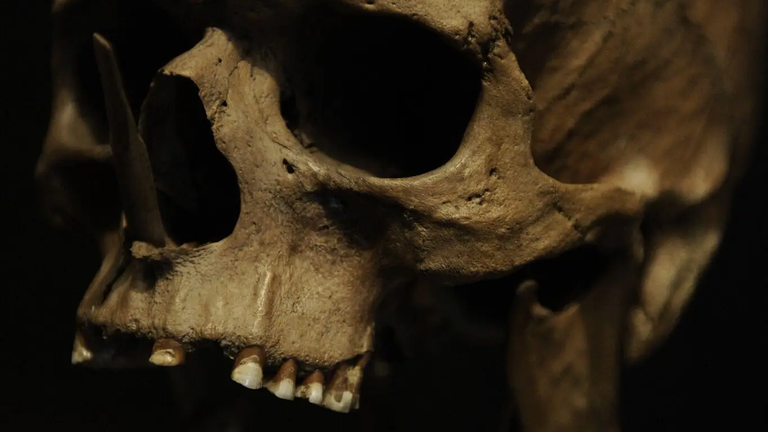 Bog Body Skull